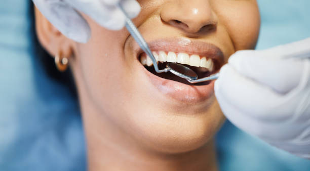 Best Dentist for Tooth Abscess  in Garden Grove, FL